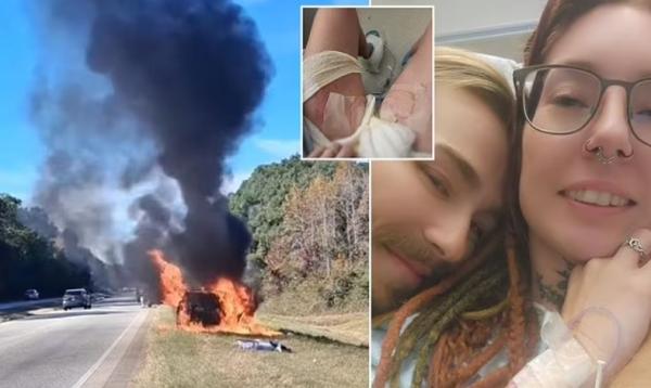 Цахилгаан тамхи дэлбэрч 32 настай эмэгтэйн машин шатаж, хөлгүй болох дөхжээ